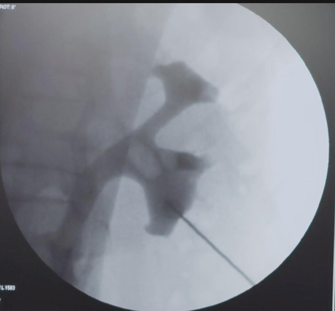 Dr Chandra Mohan Vaddi tweet media