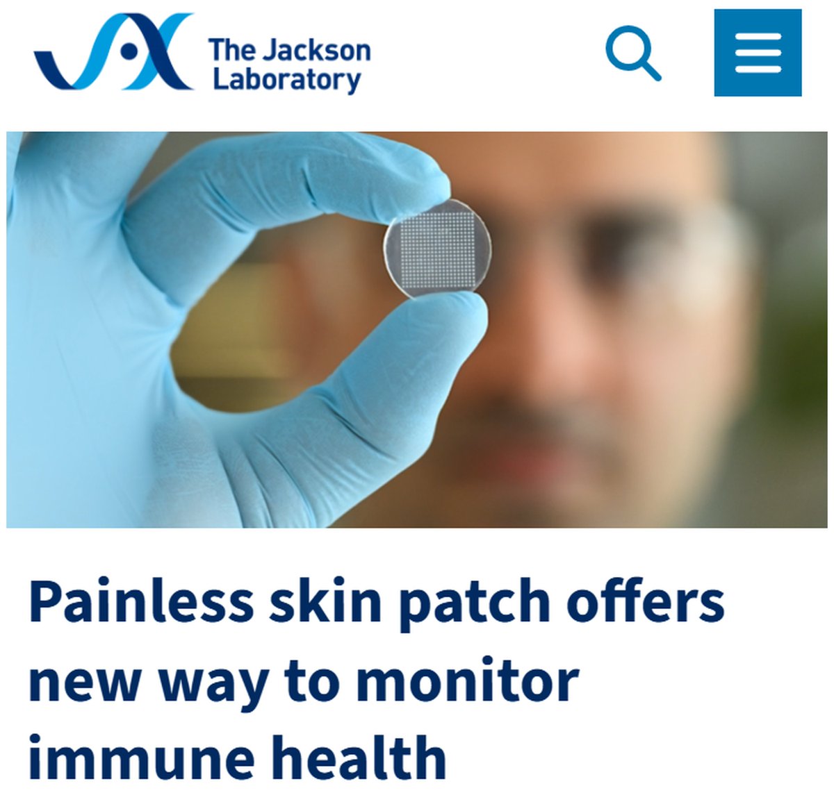 Vaccinologist's tweet photo. Really exciting work from @jacksonlab @ragoninstitute @MIT. A painless #microneedle patch that samples immune responses from the #skin could make immune monitoring far easier than biopsies or repeated blood draws. https://t.co/tDhKNzmocC https://t.co/VleGpmBr5k