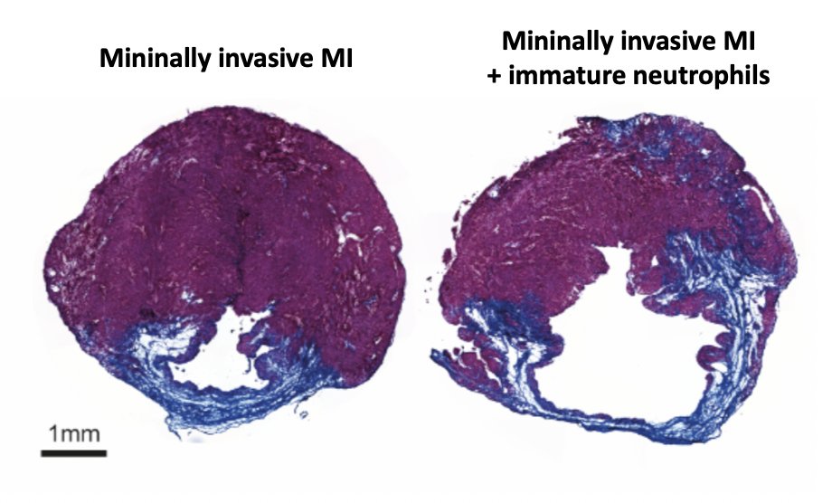 ᒍOᕼᗩᑎ ᗪᑌᑕᕼEᑎE tweet media