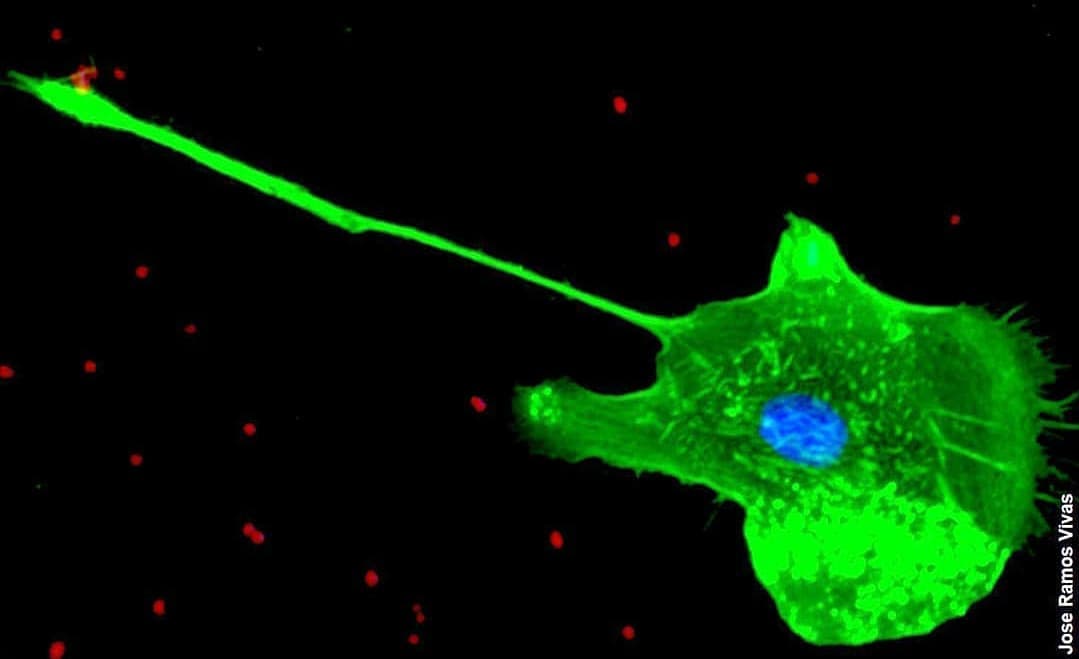 joseramosvivas's tweet photo. Una de mis mejores fotos 📸de macrófagos humanos. Capturando bacterias.

🟢Verde: Citoesqueleto (Alexa-488)
🔵Azul: Núcleo celular (DAPI)
🔴Rojo: bacteria (policlonal-Alexa 594). https://t.co/aSaxddErEj