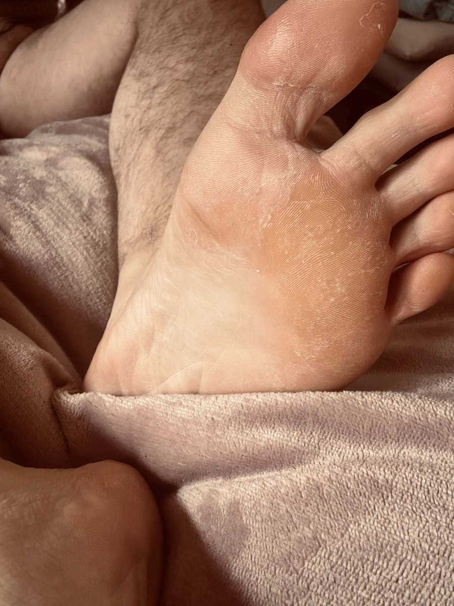 RexNoctisX's tweet photo. Anyone here into rough, cracked feet? DM me if you want to see them.

#feet #feetfetısh #smell #lick #roughtops #dom #slaveplay #beardgayman #bear https://t.co/gXR6eaQNCz