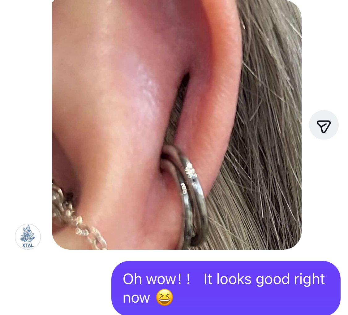 LitheCreator2's tweet image. 一则跟踪反馈✨

给海外穿孔师做的Coin slot改造反馈合集，看到这些美丽的恢复，强迫症真的非常舒心！

很感谢各位专程从海外往返支持我们，努力用更棒的作品回馈大家😊

#bodymodification 
#coinslotpiercing 
#bodypiercing 
#safepiercing 
#bodymods 
#bodymod 
#深圳穿孔 
#人体改造 
#coinslot