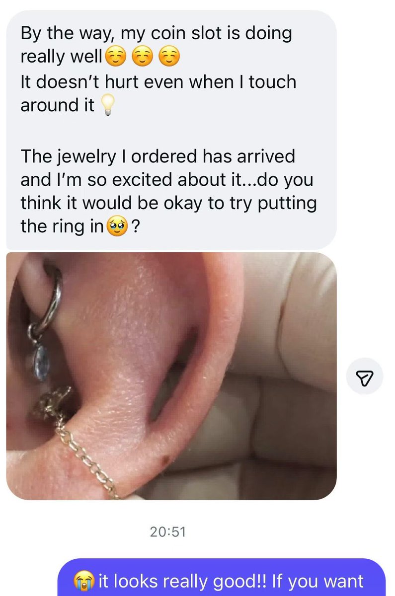 LitheCreator2's tweet image. 一则跟踪反馈✨

给海外穿孔师做的Coin slot改造反馈合集，看到这些美丽的恢复，强迫症真的非常舒心！

很感谢各位专程从海外往返支持我们，努力用更棒的作品回馈大家😊

#bodymodification 
#coinslotpiercing 
#bodypiercing 
#safepiercing 
#bodymods 
#bodymod 
#深圳穿孔 
#人体改造 
#coinslot