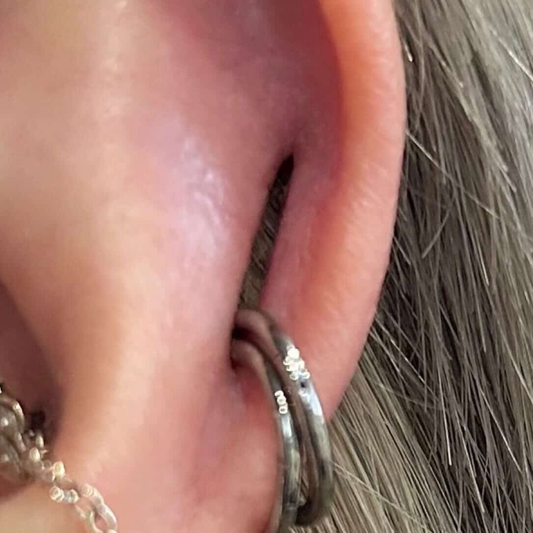 LitheCreator2's tweet image. 一则跟踪反馈✨

给海外穿孔师做的Coin slot改造反馈合集，看到这些美丽的恢复，强迫症真的非常舒心！

很感谢各位专程从海外往返支持我们，努力用更棒的作品回馈大家😊

#bodymodification 
#coinslotpiercing 
#bodypiercing 
#safepiercing 
#bodymods 
#bodymod 
#深圳穿孔 
#人体改造 
#coinslot