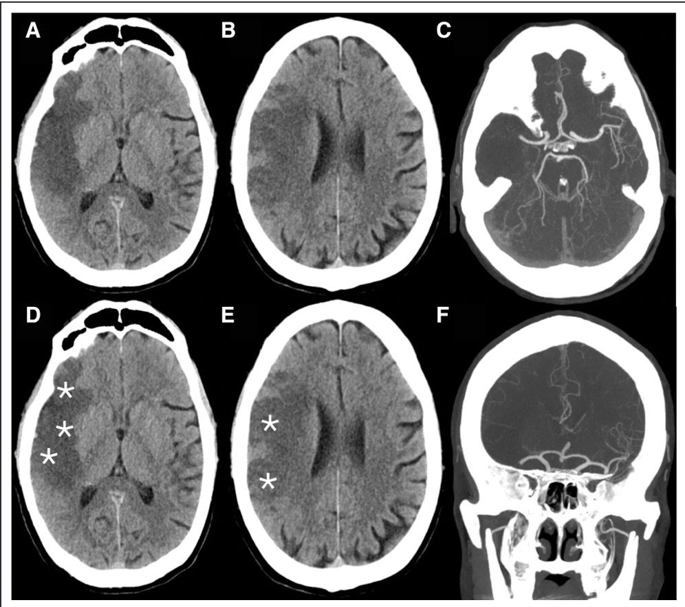Umberto Pensato tweet media