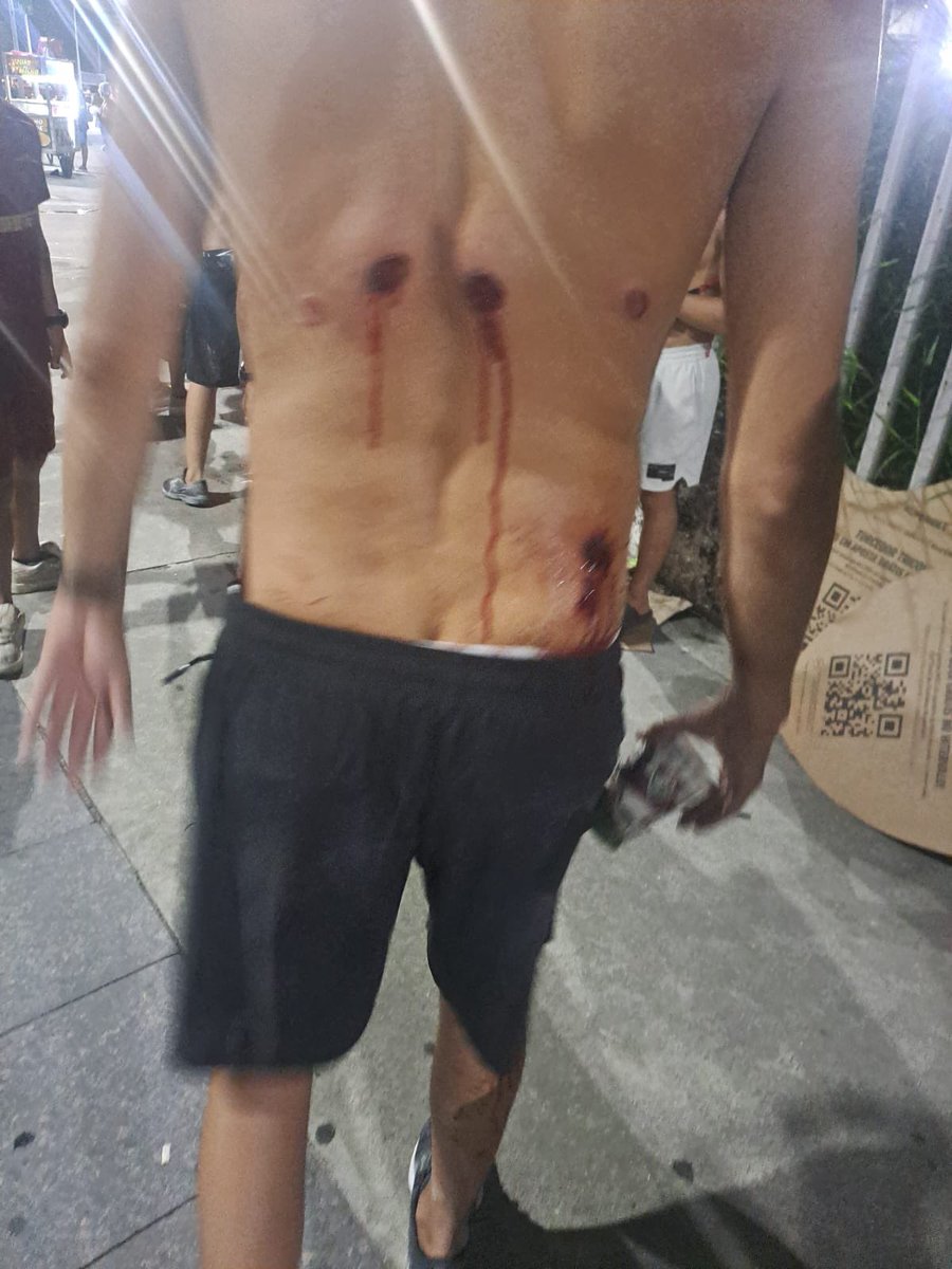 mk40ncl's tweet photo. Mais um episódio de covardia do BEPE.

Ontem um grupo de torcedores de Torcida de Bairro (que não são de Organizadas) foram surpreendidos antes de subir o metrô, membros de uma organizada do Flamengo roubaram a camisa de um deles e o BEPE mirou apenas nos Tricolores.

Um policial acertar 6 tiros nas costas de um torcedor não pode ser considerado NORMAL, outro atingido na Cabeça.

Sempre um Fla x Flu, sempre na nossa Torcida.