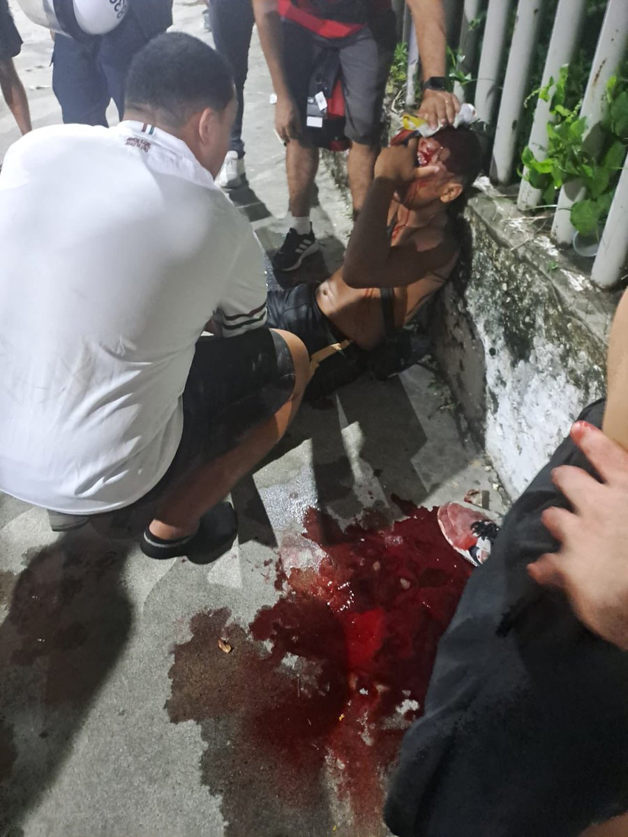 mk40ncl's tweet photo. Mais um episódio de covardia do BEPE.

Ontem um grupo de torcedores de Torcida de Bairro (que não são de Organizadas) foram surpreendidos antes de subir o metrô, membros de uma organizada do Flamengo roubaram a camisa de um deles e o BEPE mirou apenas nos Tricolores.

Um policial acertar 6 tiros nas costas de um torcedor não pode ser considerado NORMAL, outro atingido na Cabeça.

Sempre um Fla x Flu, sempre na nossa Torcida.