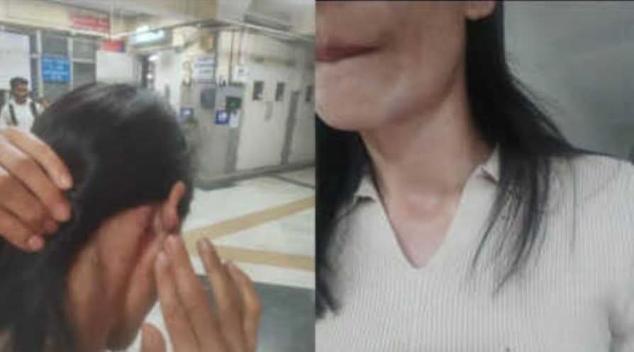 BharatMeitei's tweet image. When will stop the racial attacked towards NE people especially women . One lady from #Manipur was brutally attacked by gang in Malviya Nagar in Delhi. Is this respect towards NE people 
#stopharassment #racism #bafta2026 
@dtptraffic  @robinhibu @CMODelhi @gupta_rekha