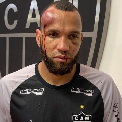 Atletico Mineiro goalkeeper Everson suffered a serious injury following a fight during the Cruzeiro match.