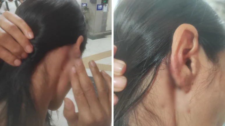 HateDetectors's tweet image. A woman from #Manipur was allegedly assaulted for objecting to harassment by a group of men near a park close to the Saket District Court complex on Sunday evening, #DelhiPolice said.

The woman, along with her friends, was taking a walk in a park when a group of men made
