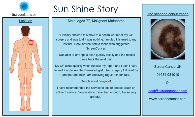 ScreenCancer UK tweet media