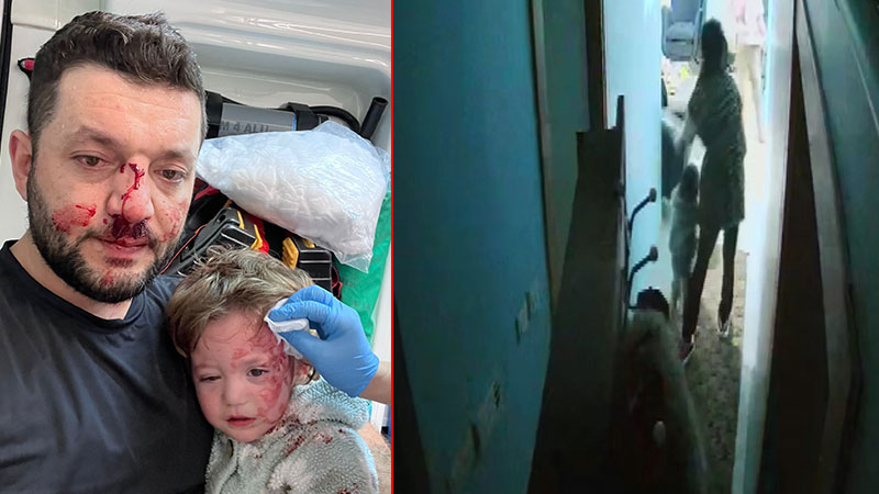 📌Baba ile 14 aylık bebeğinin darbedildiği olayda şüphelilerin ifadesi ortaya çıktı

📎dha.com.tr/2826084