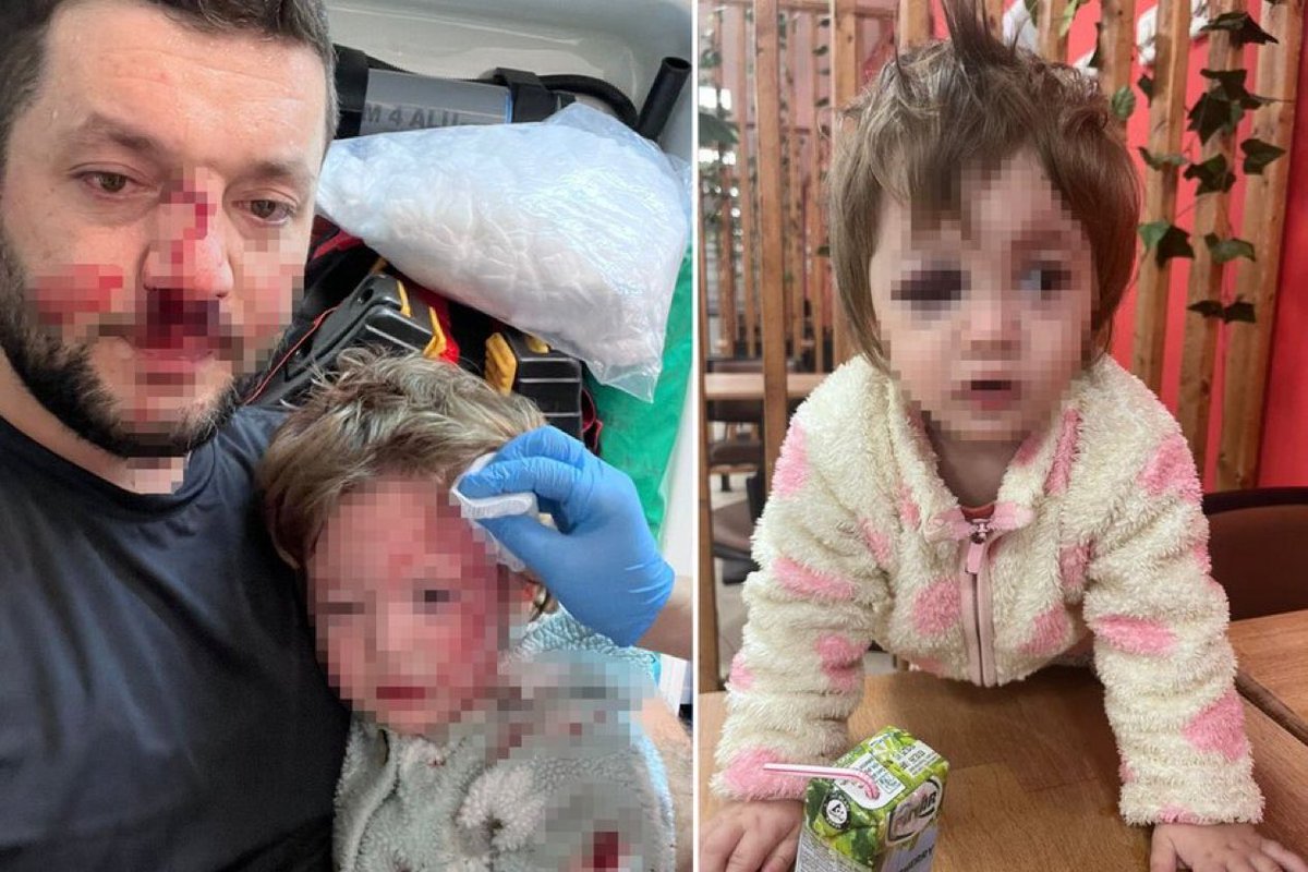 Yalova'da Muhammed Baca ve kucağında 14 aylık kızı İkra’ya saldıran şahsın emniyetteki ifadesi ortaya çıktı:

“Benim amacım Muhammed Baca'ya vurmaktı. Ancak savurduğum cisim kucağındaki çocuğa denk geldi.”