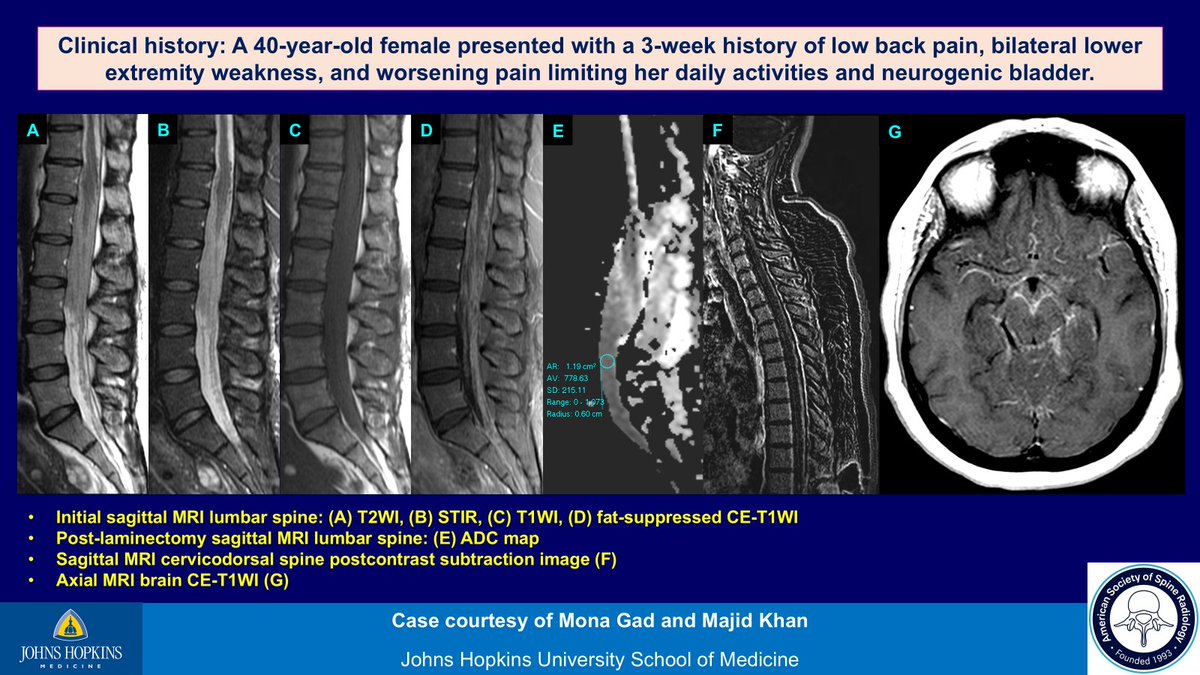 Mona Gad, MD tweet media