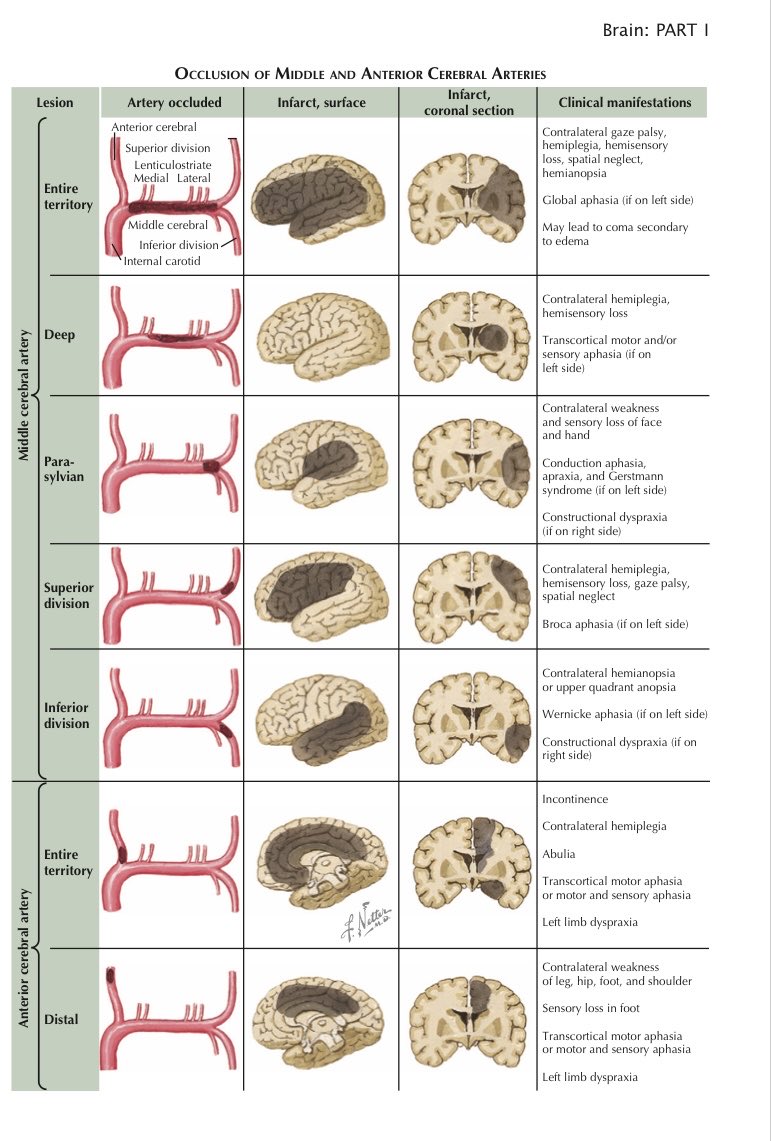 TrackYourHeart's tweet photo. Anterior circulation stroke presentations https://t.co/ir4B94CW2t