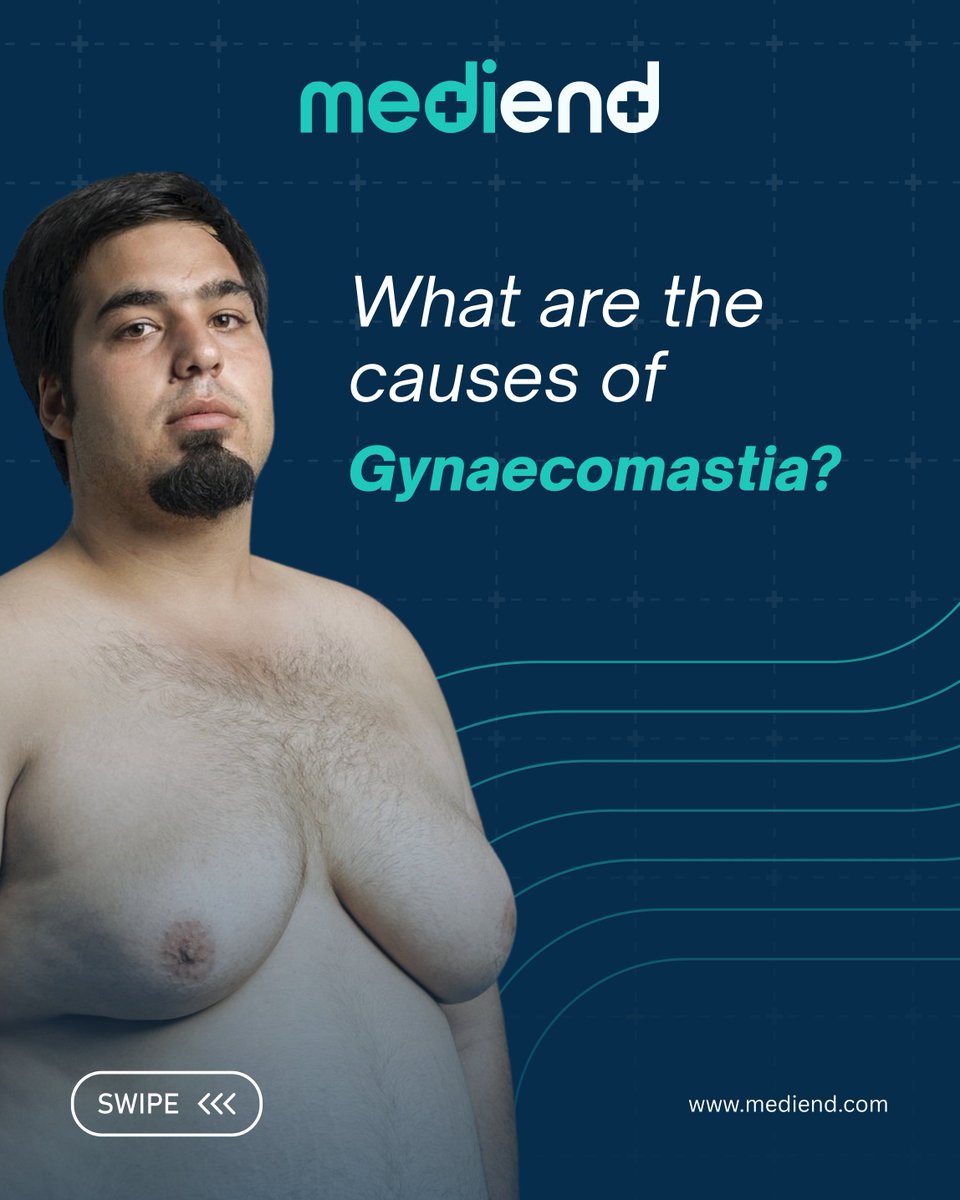 medi_end_'s tweet photo. Uncomfortable with excess chest fat?
It could be #Gynecomastia.
MediEND offers advanced, minimally invasive gynecomastia surgery with:
✨ Expert Surgeons
✨ Safe &amp; Modern Techniques
✨ Faster Recovery
✨ Cashless &amp; No-Cost EMI Options

#Gynecomastia #MaleChestReduction #MediEND https://t.co/RSsb27Tz7j
