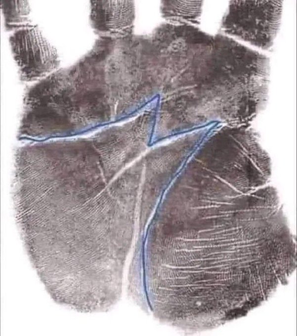 Do you have this on your hands be honest 

Reply
Yes or No