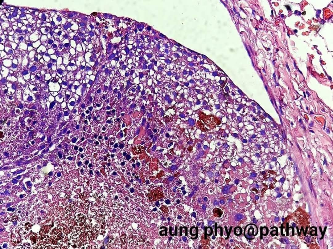 aung phyo tweet media