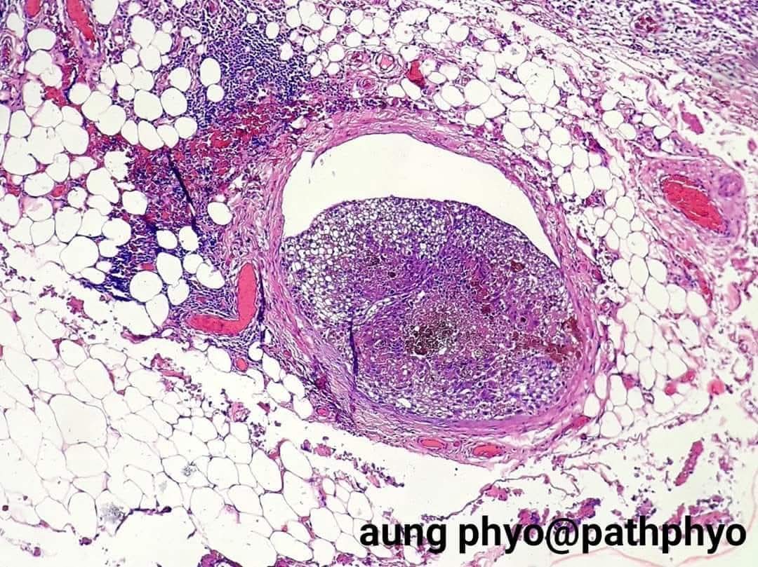 aung phyo tweet media