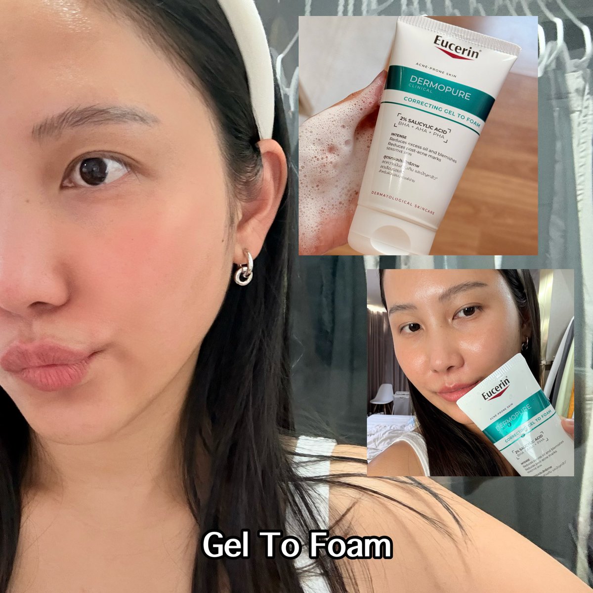สิวอยู่ทุกเทรนด์ บอกเลย แต่แค่เข้าใจว่าจะรักษาและเมนเทนยังไงแค่นี้จิ๊บๆ หลังออกจากป่า ได้ลอง Eucerin DermoPure Clinical สินค้าใหม่ที่เค้ามาจัดการสิวและรอยดำได้ทันเวลา ใช้ตัว Gel To Foam และ Triple Action จัดการทันใจ ป่าใหม่รอเลย คือหน้าใหม่เหมือนกัน เริ่ดๆ