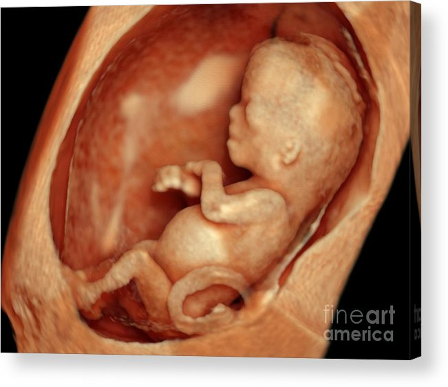 LifeNewsHQ's tweet photo. This is an unborn baby at 12 weeks, when most abortions occur.  

There can be no doubt that abortions kill babies. https://t.co/2GHWYYgegm