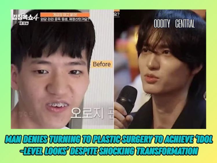 OddityCentral's tweet image. A South Korean man has gone viral after claiming to have achieved a shocking physical transformation solely with makeup and hairstyling tricks. 

odditycentral.com/news/man-denie… 

#plasticsurgery #SouthKorea #viral #Asia