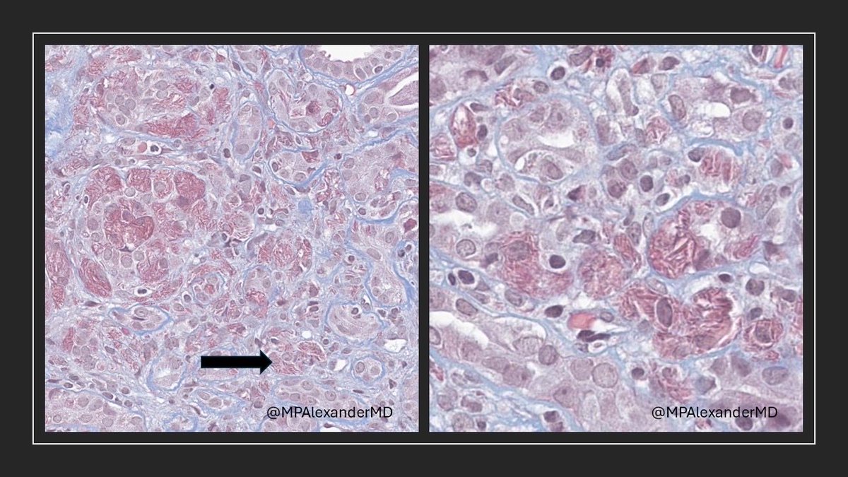 Priya Alexander, MD tweet media