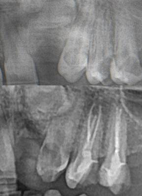 Maxilla ( Önder Çalışkan ) tweet media