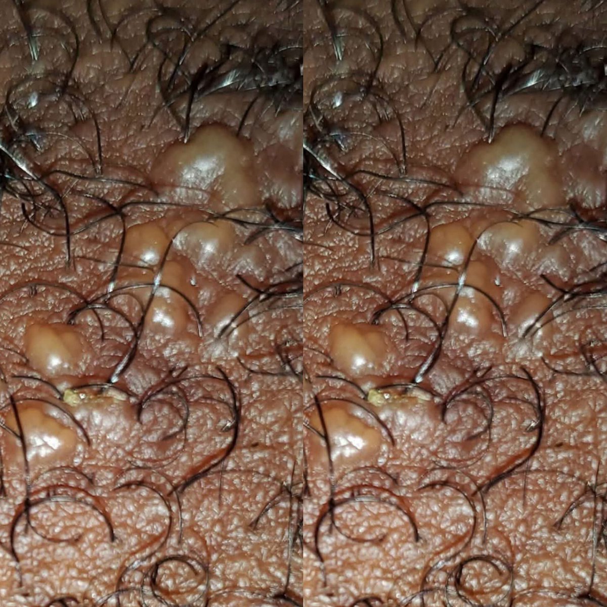 Biira Bryphine tweet media