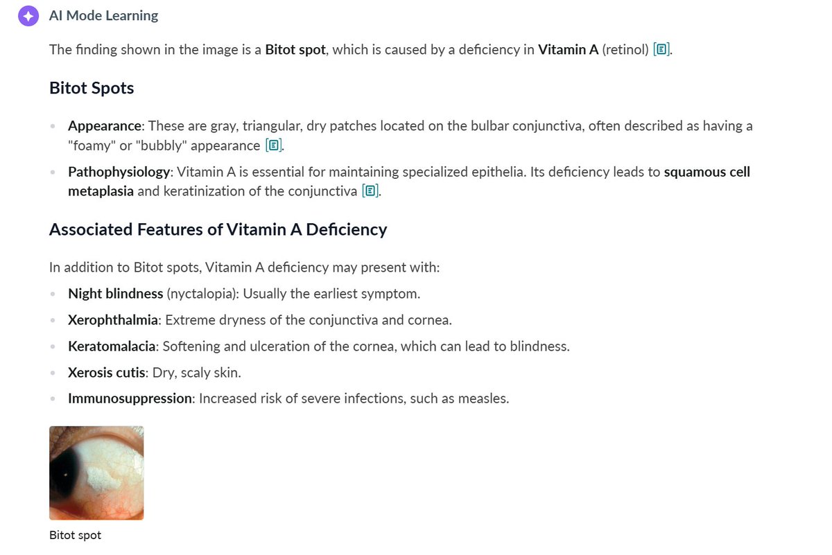 MedAmboss's tweet photo. @AB_drmd A. Vitamin A ✅
Source: Amboss Ai 📖 https://t.co/qkHIxId5KB