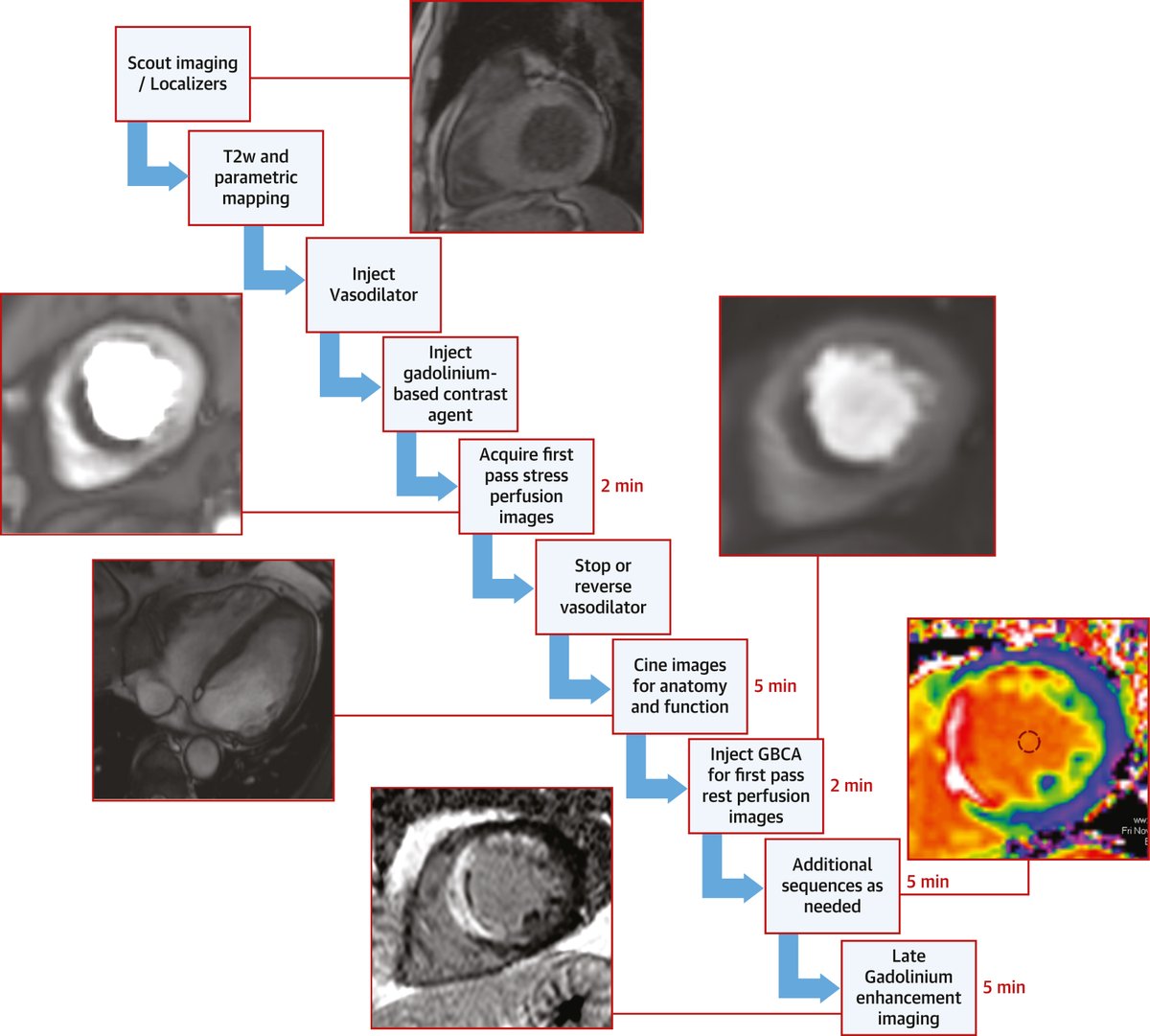 JACCJournals's tweet image. Stress #WhyCMR and CAD case-based approach: In this imaging vignette, clinical stress #CMR cases are presented, highlighting the utility of stress CMR in the assessment and management of CAD as well as non-CAD jacc.org/doi/10.1016/j.…

#cvCAD #JACCIMG