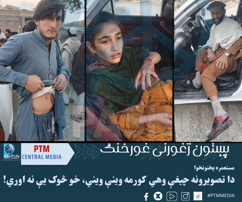 PtmCentral's tweet photo. په Kurram District کې عام ولس یو ځل بیا د مارټر ښکار شو.
ټپي ځوانان، ژوبل ماشومان — دا ترهګر نه دي، دا انسانان دي.

که جګړه د ترهګرۍ پر ضد ده،
نو ولس ولې وژل کېږي؟

امن زموږ حق دی، هدف نه.

#KurramBleeds #StopTargetingCivilians #HumanRights #EndViolence https://t.co/lC7F0TTvbv