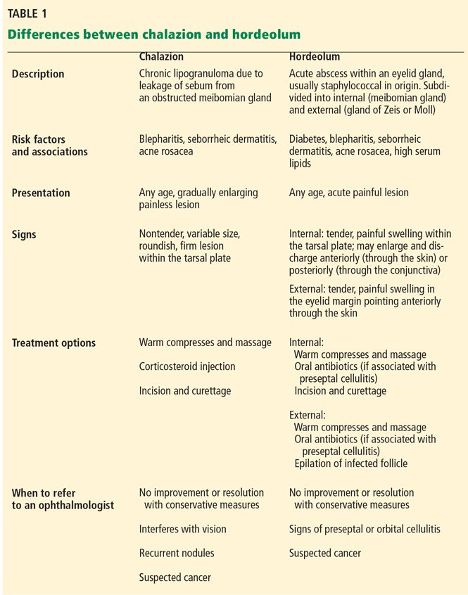 <a href="/IhabFathiSulima/">Dr Ihab Suliman</a> Inflammation +redness + around the eye

Dx--Blepharitis/ stye

Approach 
Ampiclox-cloxacilin body/kg -6hyrly / Gentamycin 0.1% eye drop 
Or
Amoxicilin 25mg/kg  -up to 40mg/kg.
Plus Nsaids ie ibuprofen. 

IND !

[mdedge.com/ccjm/article/1…]