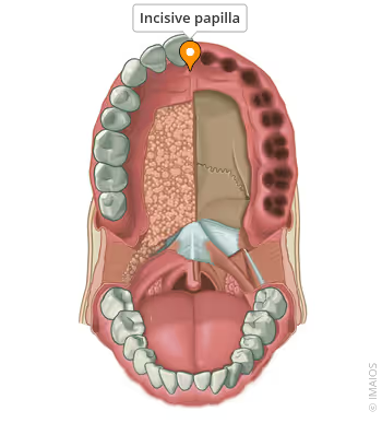 OscarPatel's tweet photo. You can make your skull more "malleable" to grow your jaw forward at any age

Just by pushing on the palate - which is basically acts as a fascial pump for cerebrospinal fluid.

When you stimulate the incisive papilla (tissue behind front teeth), you're activating the "craniosacral pump"

This:
-releases fascial adhesions from years of poor tongue posture
-mobilizes sutural restrictions that have been locked since childhood
-activates mechanotransduction (cellular signaling that triggers bone remodeling)

These are the principles by which techniques like Thumbpulling and Incisive Papilla Pushing work.

The hard palate is more than just bone - it is a dense fascial network, periosteum, vascular tissue, and a piezoelectric structure. 

Only by leveraging these characteristics does your skull get more malleable.

Then your myofunctional habits (proper tongue posture, swallowing, chewing, etc) drive the actual expansion.

The bone ALWAYS follows the fascia - release the latter and the former will develop.