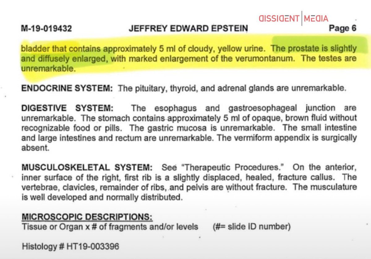 🚨EPSTEIN GREW A PROSTATE BACK?🚨

This guy is straight up still walking the earth. 

The medical examiner who studied Epstein’s corpse noted an enlarged prostate, but Epstein’s own words and medical records in the released files seem to indicate his prostate was removed.