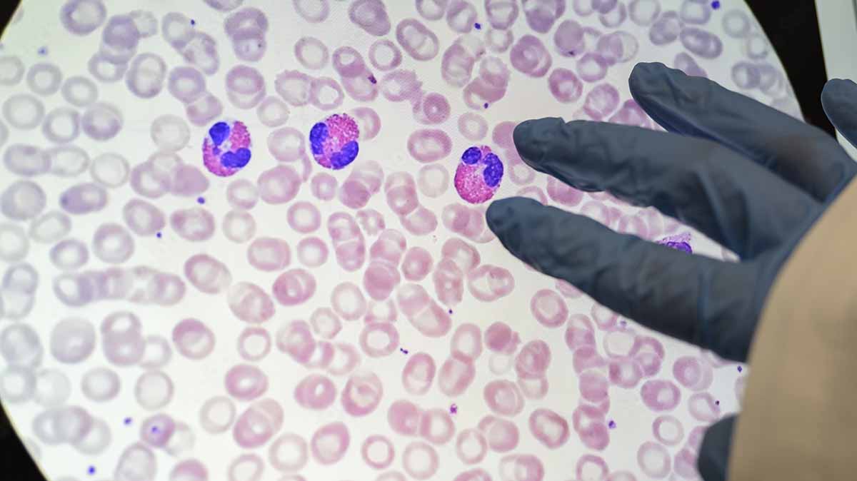 University of Arizona Research tweet media