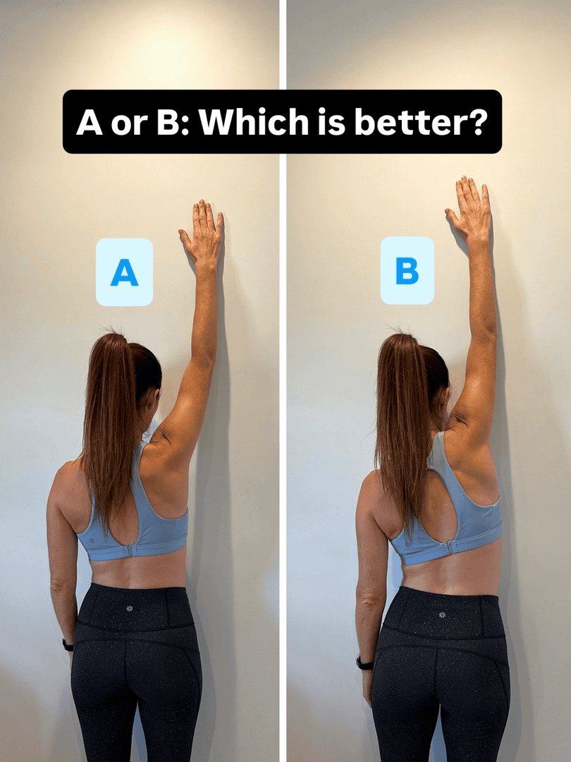 CORAPTherapy's tweet photo. A or B? Drop your vote in the comments 👇

Bonus points if you can tell us what gave it away. 👀 We’ll post the answer tomorrow and see who was right!

#PhysicalTherapy #ExerciseForm #Rehab https://t.co/AcmVXIfkw4