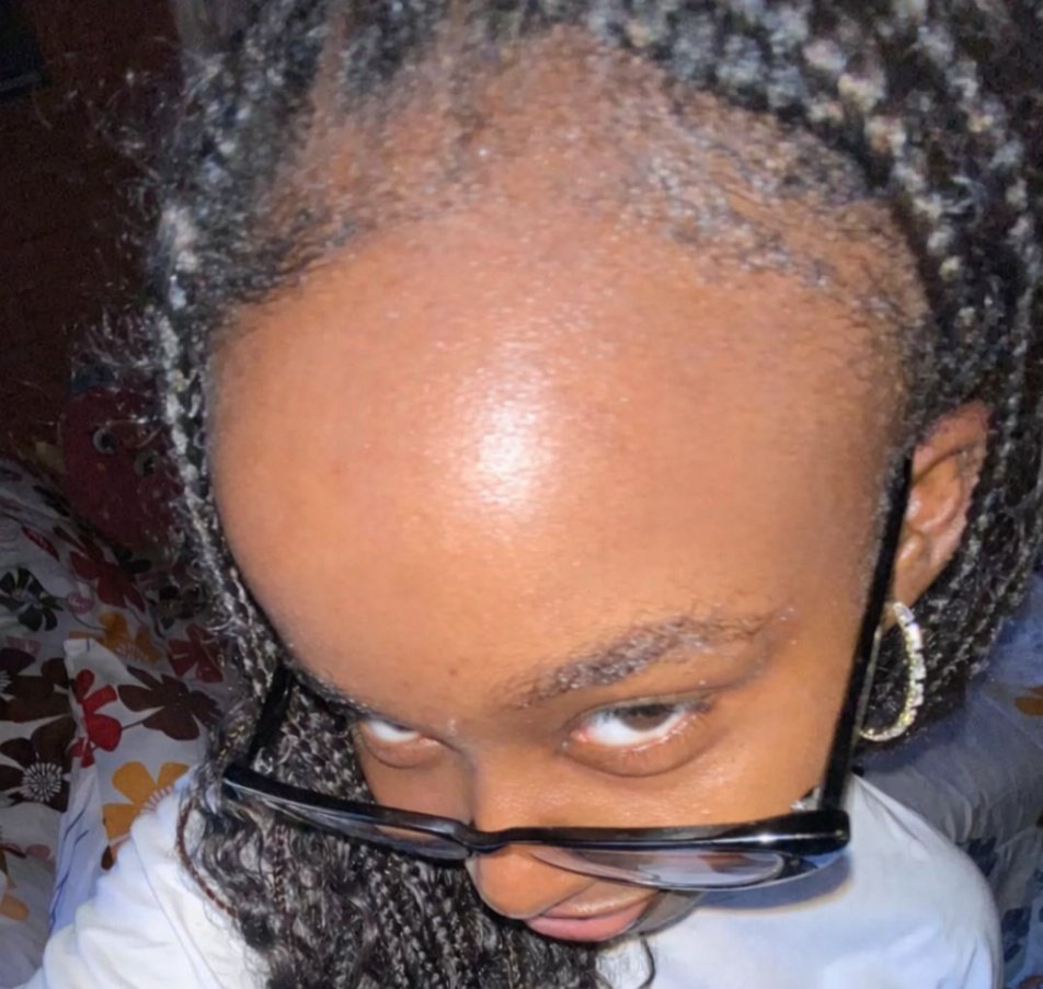 What if I sell my kidney, invest that money, get rich and buy it back?