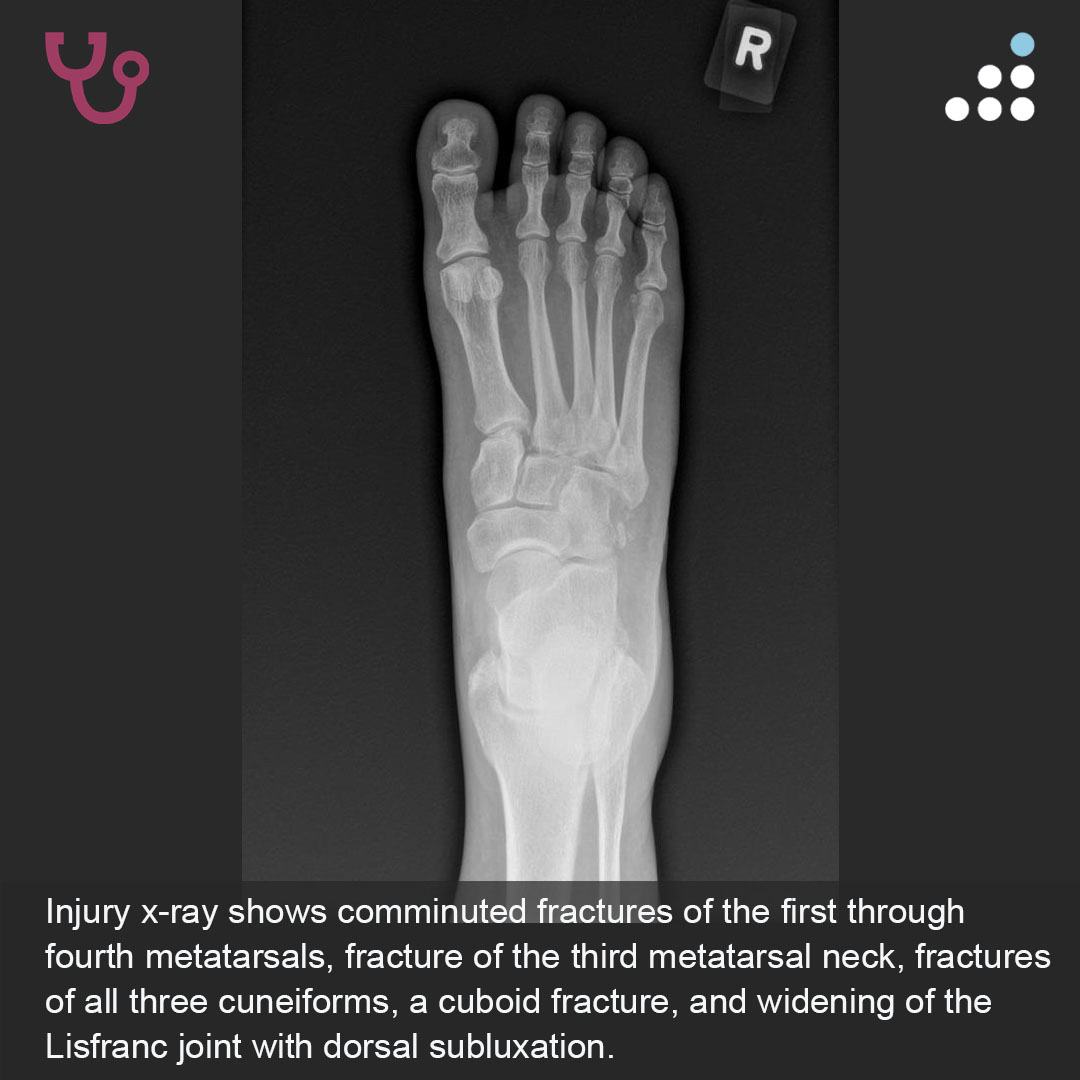 Orthobullets tweet media