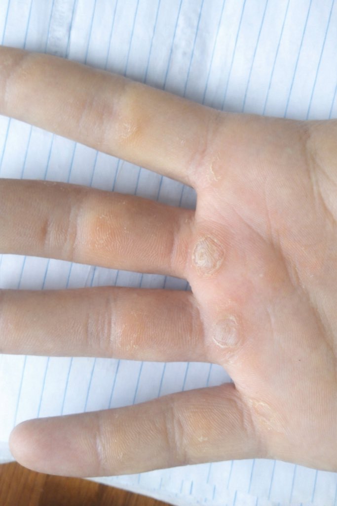 officialfitfaq's tweet photo. Be honest… would you quit when your hands start looking like this?👀🔥 #FitFAQ https://t.co/ck3ZupZ2a7