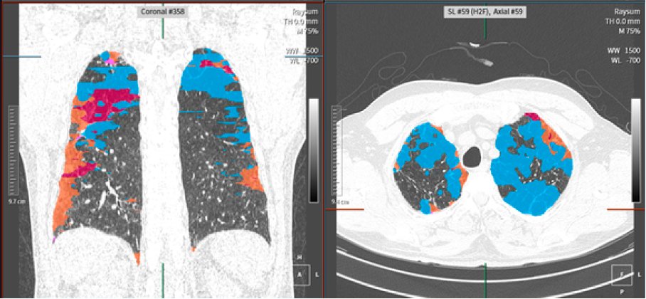 Nadine Bayerl, MD tweet media