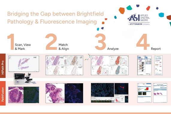 Digital pathology works best when every step of the workflow is connected. ASI’s platform supports the full process - from slide scanning and visualization through tissue alignment and multimodal analysis to standardized reporting and LIS integration.

#DigitalPathology #WSI #IHC