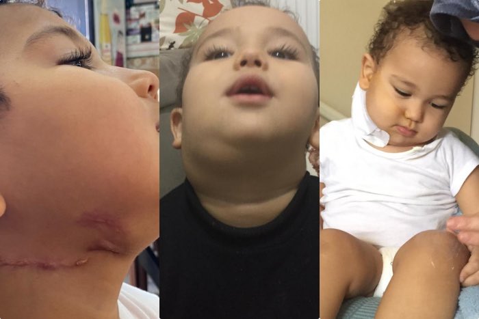 Üç yıldır verem hastalığıyla mücadele eden Selman'ın (4) anne-babası Melek-Yusuf Tekin, 12 Eylül'de Edirne'de tutuklandı. 

Hasta çocukları annesiz-babasız bırakmak zulümdür. <a href="/adalet_bakanlik/">T.C. Adalet Bakanlığı</a> 

SelmanaAnnesini Verin