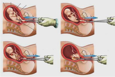 Меланія Грунт tweet media