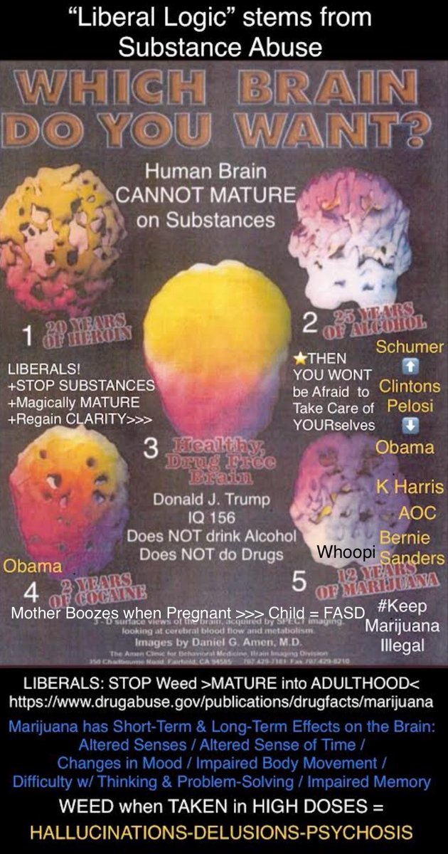 Shauna333R's tweet photo. #DemocratsImaginaryWorld💫
#LiberalsImaginaryWorld💫
@TheDemocrats @DNC et al =
>>>>>#IMMATURE<<<<<
⬇️ ⬇️ ⬇️ ⬇️ ⬇️ ⬇️ ⬇️ ⬇️
~ #AdolescentMentality
~ #AttentionSeeking
~ #Dramatic
~ #Emotional
~ #SelfServing
~ #Unprofessional
~ #Petulant
~ #PitifulSouls
>>>>>#GrowUp<<<<<
#MarijuanaSideEffects:
~ #AlteredSenses
~ #AlteredSenseOfTime
~ #ChangesMood
~ #ImpairedBodyMovement
~ #DifficultyThinking
~ #DifficultyProblemSolving
~ #ImpairedMemory
WHEN TAKEN in HIGH DOSES:
~ #Anxiety
~ #Distrust
~ #Fear
~ #Panic
>>>#Delusions<<<
>>>#Hallucinations<<<
>>>#Psychosis<<<
https://t.co/xp9ORgZIDo
#KeepMarijuanaILLEGAL