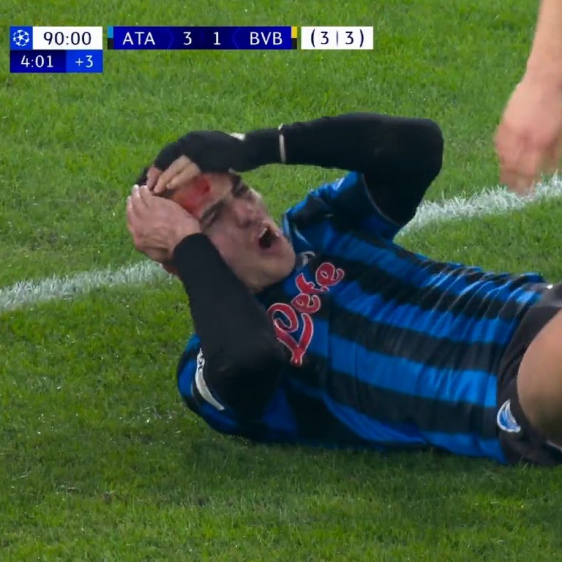 Hay un jugador con sangre y el árbitro ha tenido que ir a verla en el VAR

Los árbitros españoles son tan malos que asustan