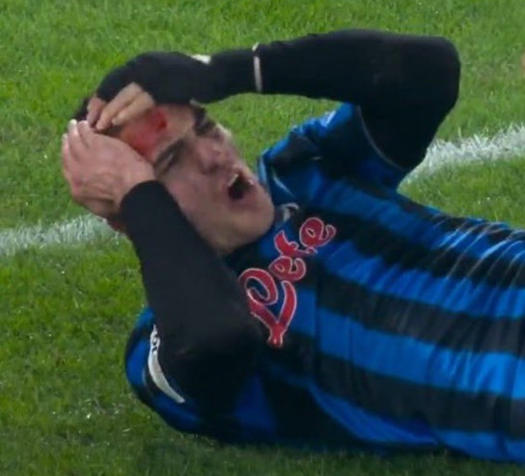 VfB_Zoneee's tweet image. Ich sag das Blut war wie bei Hakimis Verletzung für 50% der Entscheidung des Schiedsrichter Schuld. Ohne Blut gibt der hier niemals Elfmeter. Der Kopf ist unter Hüfthöhe des Gegenspielers, Bensebaini sieht seinen Gegenspieler nicht außer er hat einen Rückspiegel #ATABVB #PSGFCB