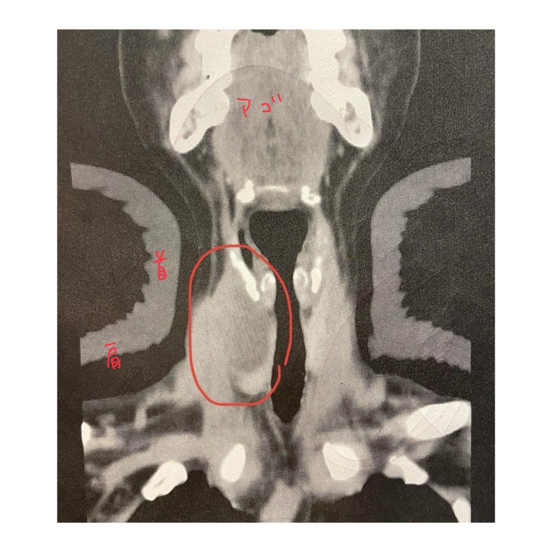 さぁさ tweet media