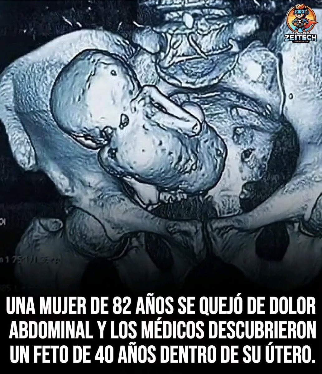 pinupseniorgirl's tweet photo. ¡¡AHÍ  ESTABA SEGURO !! ❤️ https://t.co/9wDoXniFnr
