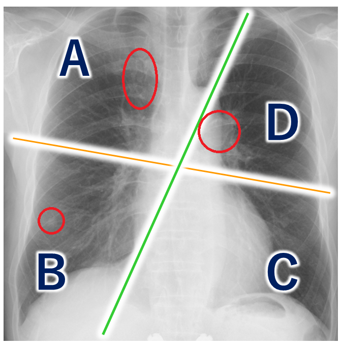 わ、わかんねぇ～！ 疑ってかかると全部怪しく見えちゃう